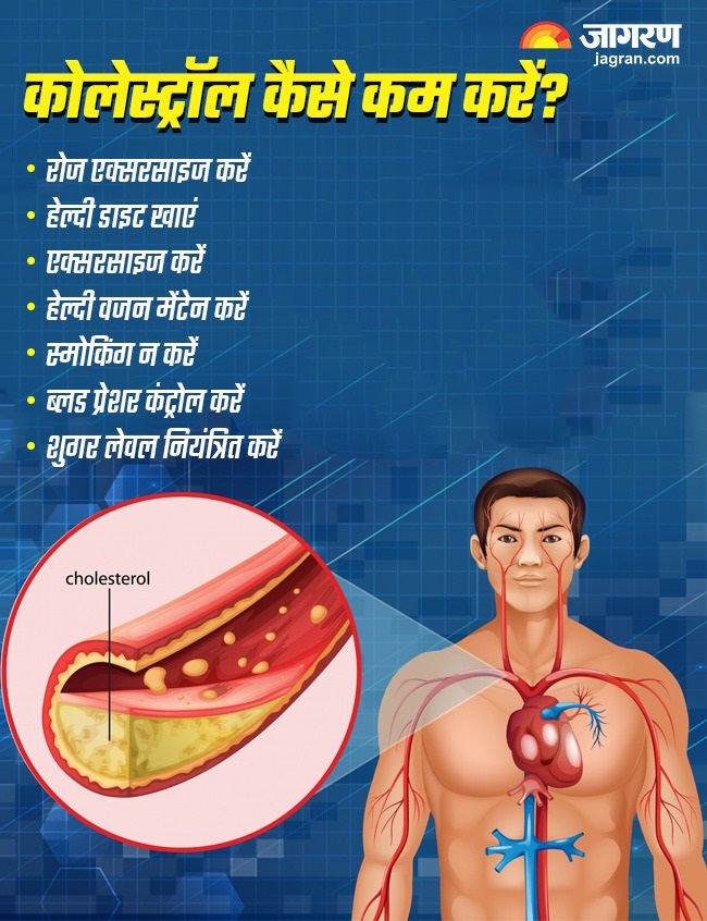 signs of high cholesterol